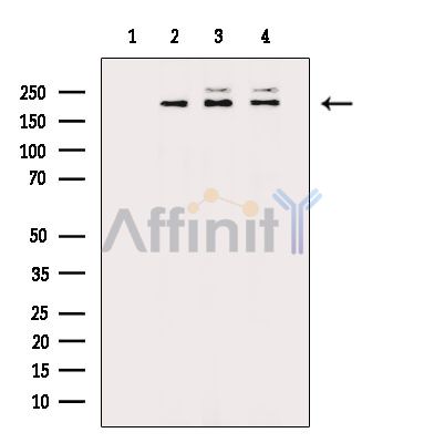 Rictor Antibody - Western blot analysis of extracts from various samples, using Rictor Antibody.