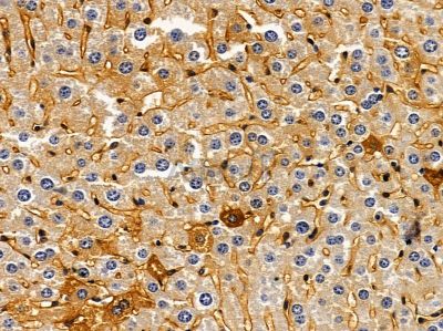 DAB2 Antibody - DF7792 at 1/100 staining mouse liver tissue by IHC-P.