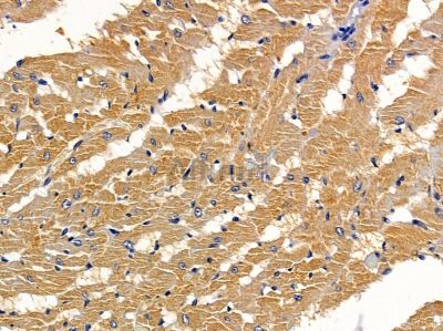 DAB2 Antibody - DF7792 at 1/100 staining rat heart tissue by IHC-P.