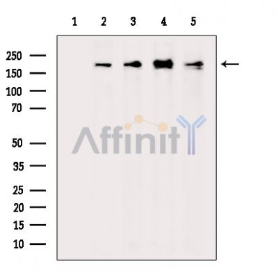 Scribble Antibody - Western blot analysis of extracts from various samples, using Scribble Antibody.