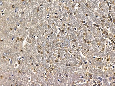 HoxB4 Antibody - DF8560 at 1/100 staining rat brain tissue by IHC-P.