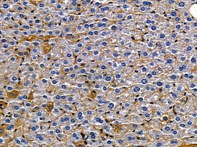 Nav1.6/SCN8A Antibody - DF8577 at 1/100 staining mouse liver tissue by IHC-P.