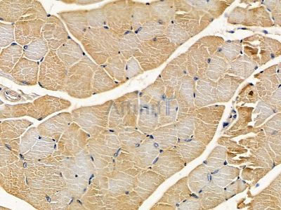 DOK5 Antibody - DF8651 at 1/100 staining mouse muscle tissue by IHC-P.