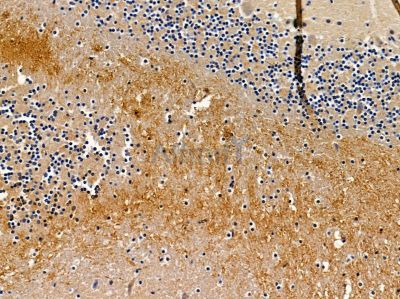 TPD52L1 Antibody - DF8833 at 1/100 staining mouse brain tissue by IHC-P.