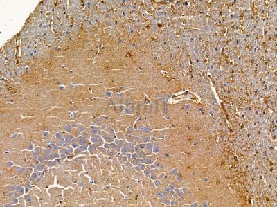 TPD52L1 Antibody - DF8833 at 1/100 staining rat brain tissue by IHC-P.