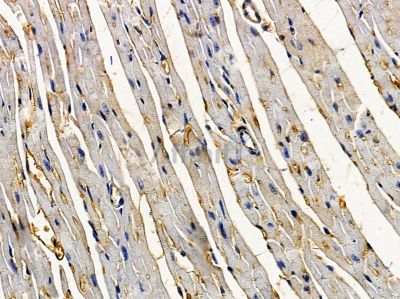 ARHGEF17 Antibody - DF8862 at 1/100 staining mouse heart tissue by IHC-P.