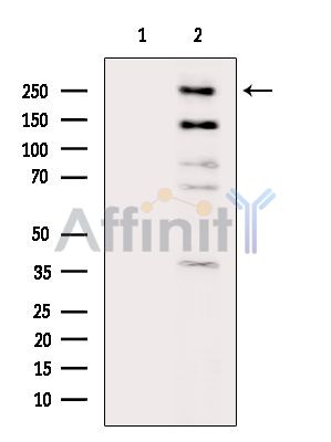 KDM5A Antibody - Western blot analysis of extracts from Mouse brain, using KDM5A Antibody.