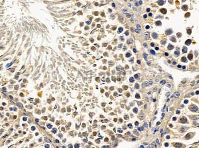 MAGEA4 Antibody - DF9014 at 1/100 staining rat testis tissue by IHC-P.