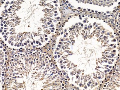 ABCC11 Antibody - DF9253 at 1/100 staining rat testis tissue by IHC-P.