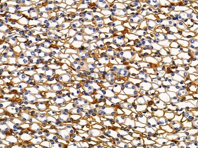 KCNJ15 Antibody - DF9262 at 1/100 staining mouse kidney tissue by IHC-P.