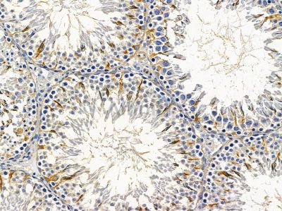 CHAC1 Antibody - DF9353 at 1/100 staining rat testis tissue by IHC-P.
