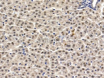 CHD6 Antibody - DF9382 at 1/100 staining rat liver tissue by IHC-P.