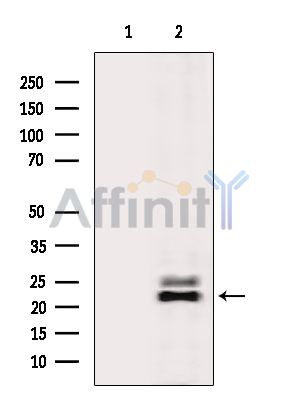 DIRAS2 Antibody - Western blot analysis of extracts from Rat liver, using DIRAS2 Antibody.