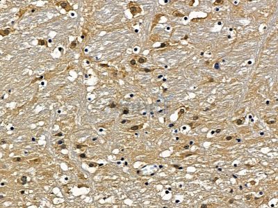 NAV2 Antibody - DF9695 at 1/100 staining mouse brain tissue by IHC-P.