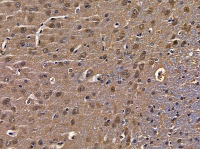 RAB17 Antibody - DF9815 at 1/100 staining rat brain tissue by IHC-P.