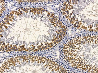 RAB1A Antibody - DF9817 at 1/100 staining rat testis tissue by IHC-P.