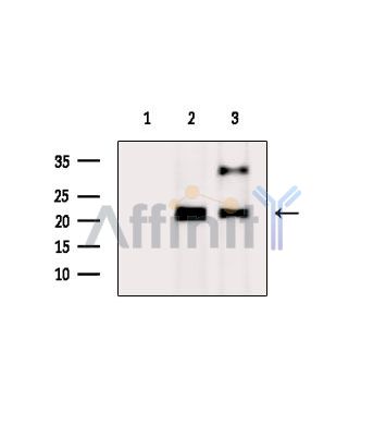 RAB22A Antibody - Western blot analysis of extracts from various samples, using RAB22A Antibody.