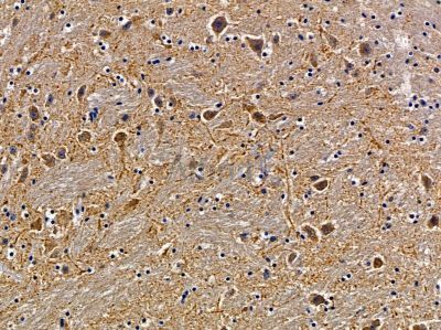 SH3TC2 Antibody - DF9903 at 1/100 staining mouse brain tissue by IHC-P.