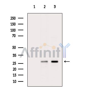 Phospho-Rab8 (Thr72) Antibody - Western blot analysis of extracts from various samples, using Phospho-Rab8 (Thr72) Antibody.