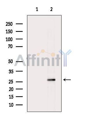 Phospho-GRAP2 (Thr262) Antibody - Western blot analysis of extracts from PC12 cells(heat-shock treatment), using Phospho-GRAP2 (Thr262) Antibody.