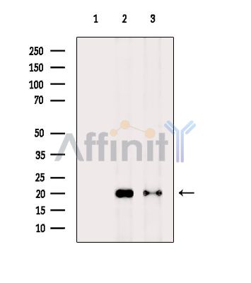 Acetyl-H2A.Z (Lys4/7/11/13) Antibody - Western blot analysis of extracts from various samples, using Acetyl-H2A.