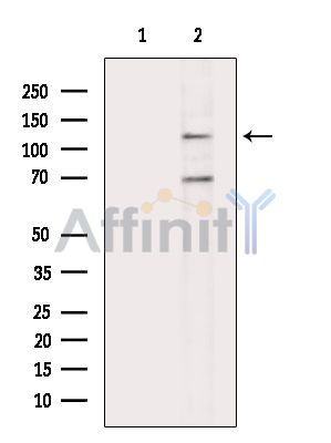Phospho-ULK1 (Ser757)[Ser758] Antibody - Western blot analysis of extracts from 293 cells, using Phospho-ULK1 (Ser757)[Ser758] Antibody.