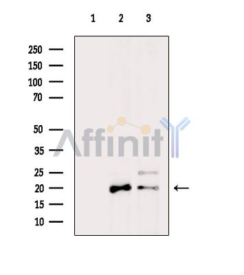 COX IV Antibody - Western blot analysis of extracts from various samples, using COX IV Antibody.