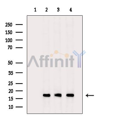RBP1 Antibody - Western blot analysis of extracts from various samples, using RBP1 Antibody.