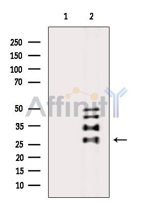 COQ10B Antibody - Western blot analysis of extracts from K562 cells(serum starvation treatment), using COQ10B Antibody.
