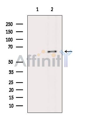 SLC38A4 Antibody - Western blot analysis of extracts from Rat lung, using SLC38A4 Antibody.