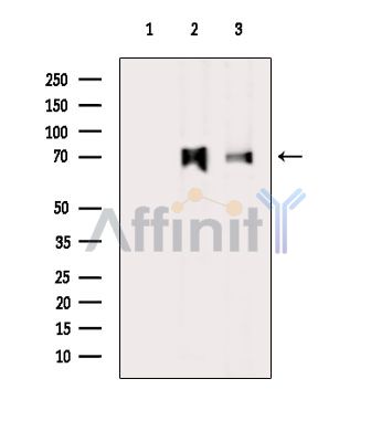 DLAT Antibody - Western blot analysis of extracts from various samples, using Pyruvate Dehydrogenase E2 Antibody.