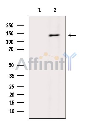 alpha COP I Antibody - Western blot analysis of extracts from Rat lung, using alpha COP I Antibody.