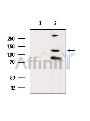 WDR60 Antibody - Western blot analysis of extracts from MCF7 cells(serum starvation treatment), using WDR60 Antibody.