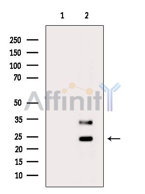 TP53INP2 Antibody - Western blot analysis of extracts from K562 cells(serum starvation treatment), using TP53INP2 Antibody.