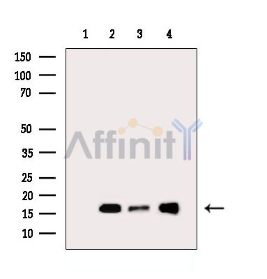 PPP1R11 Antibody - Western blot analysis of extracts from various samples, using PPP1R11 Antibody.