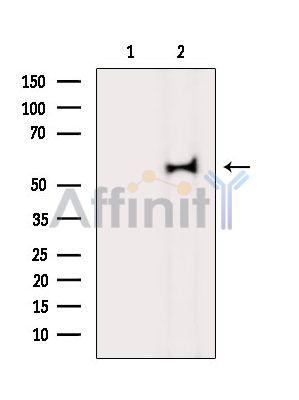 GCM2 Antibody - Western blot analysis of extracts from K562 cells(UV treatment), using GCM2 Antibody.