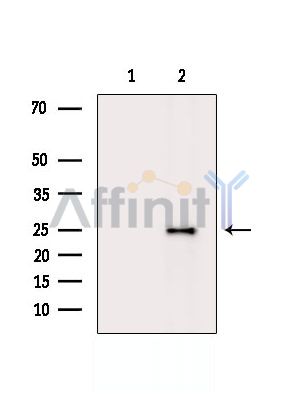 RAB3B Antibody - Western blot analysis of extracts from K562 cells(serum starvation treatment), using RAB3B Antibody.