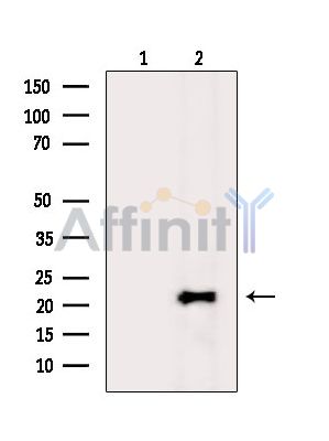 TIFA Antibody - Western blot analysis of extracts from Rat lung, using TIFA Antibody.