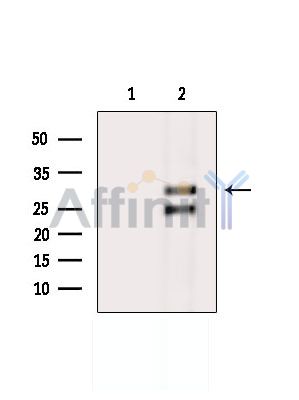 BCAP29 Antibody - Western blot analysis of extracts from MCF7 cells(serum starvation treatment), using BCAP29 Antibody.