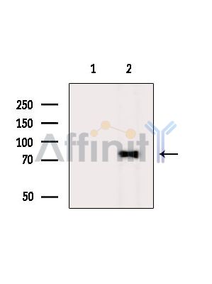 RTF1 Antibody - Western blot analysis of extracts from K562 cells(serum starvation treatment), using RTF1 Antibody.