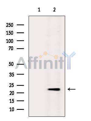 CRIP2 Antibody - Western blot analysis of extracts from Rat lung, using CRIP2 Antibody.