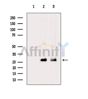 UBE2G2 Antibody - Western blot analysis of extracts from various samples, using UBE2G2 Antibody.