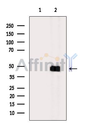 SLC17A3 Antibody - Western blot analysis of extracts from MCF7 cells(serum starvation treatment), using SLC17A3 Antibody.