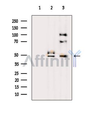 ZP3 Antibody - Western blot analysis of extracts from various samples, using ZP3 Antibody.