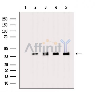 MOSPD3 Antibody - Western blot analysis of extracts from various samples, using MOSPD3 Antibody.