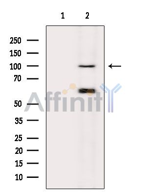 SLITRK2 Antibody - Western blot analysis of extracts from MCF7 cells(serum starvation treatment), using SLITRK2 Antibody.