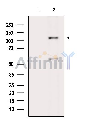 ABI3BP Antibody - Western blot analysis of extracts from Rat lung, using ABI3BP Antibody.