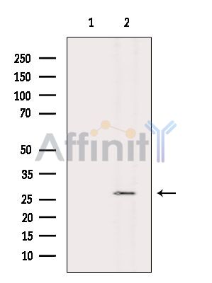 NIPSNAP3A Antibody - Western blot analysis of extracts from Mouse liver, using NIPSNAP3A Antibody.