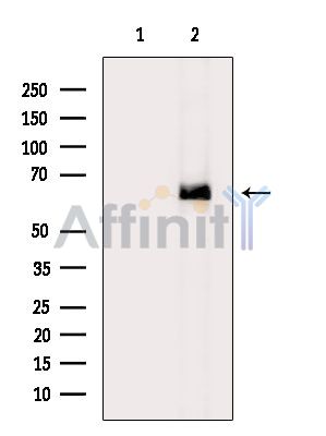FBXO31 Antibody - Western blot analysis of extracts from Rat lung, using FBXO31 Antibody.