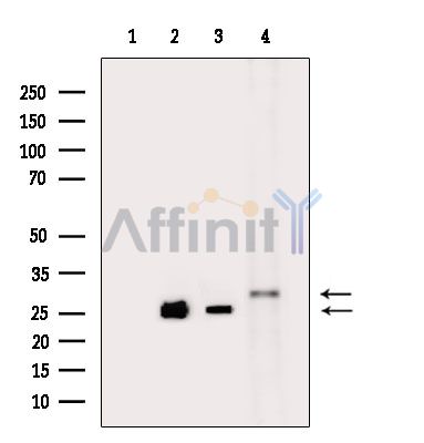 COX18 Antibody - Western blot analysis of extracts from various samples, using COX18 Antibody.